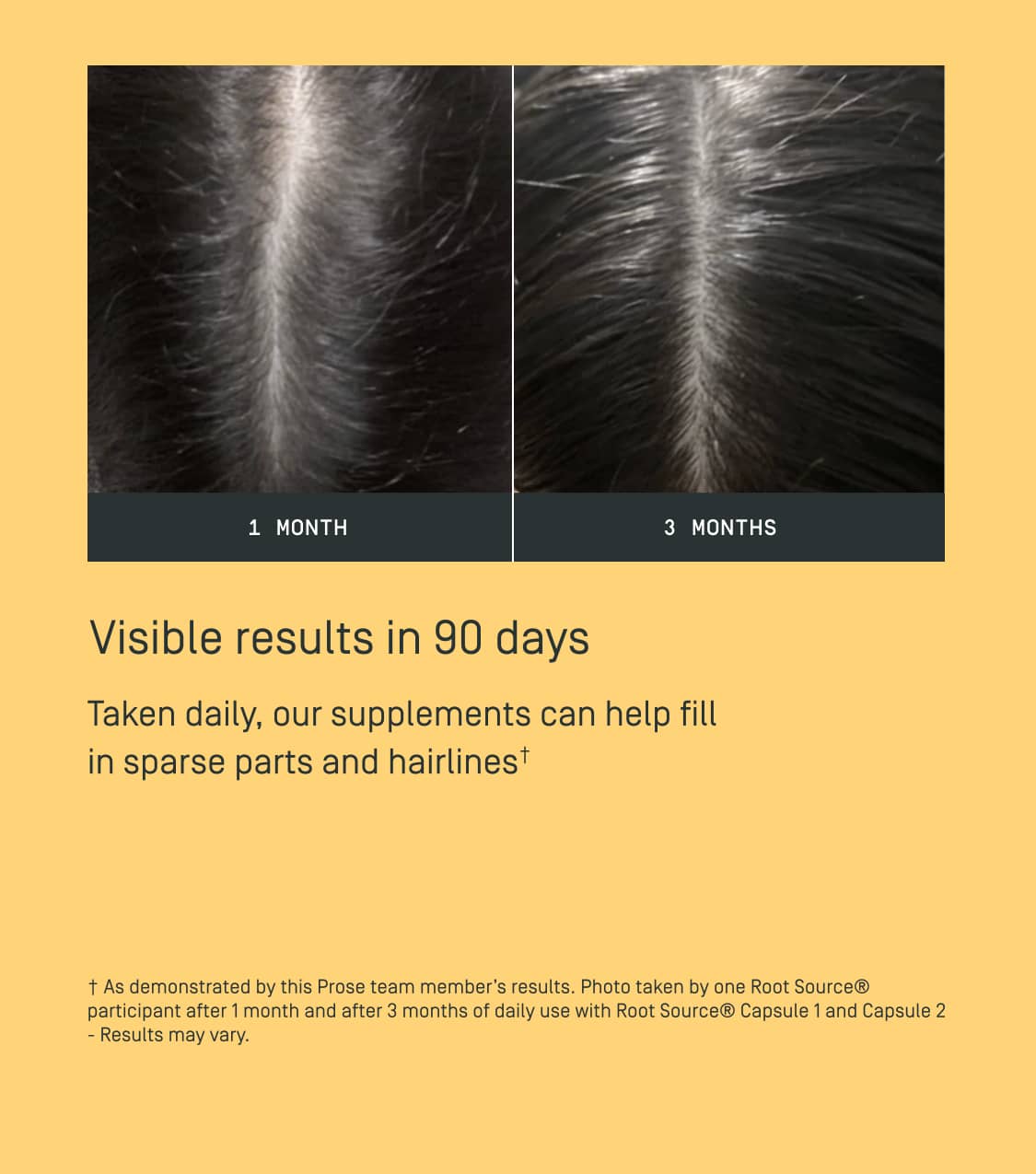 Prose-custom-root-source-hair-supplements-results-after-using-for-90-days.jpg